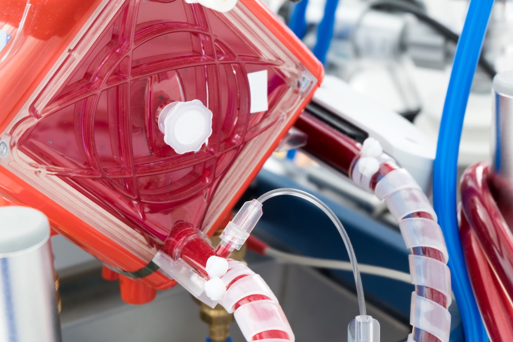 Normothermic perfusion technology like the kind seen in ECMO machines is extending the viability of livers from cardiac death donation.